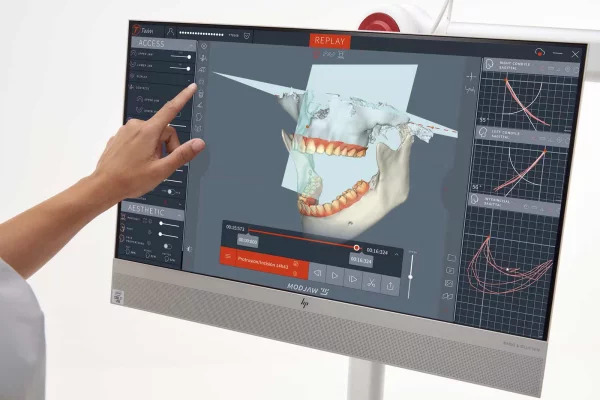 Modjaw Real-Time Jaw Motion bei DentalGut in Mainz